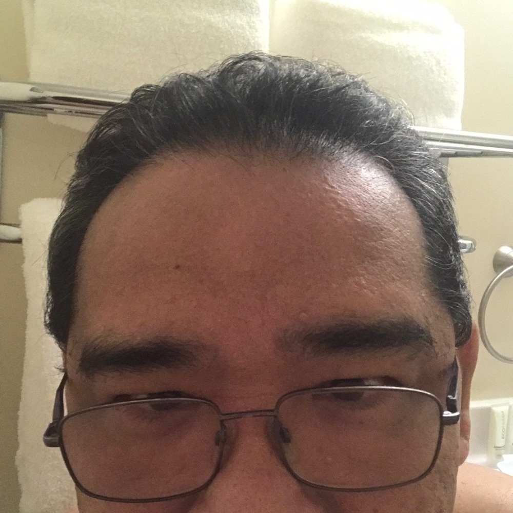 Meet your Posher, Wilmer